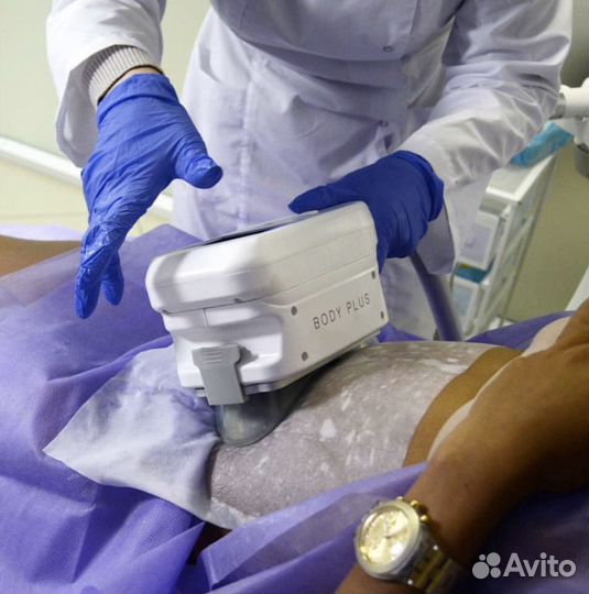 Криолиполиз. Безоперационная липосакция