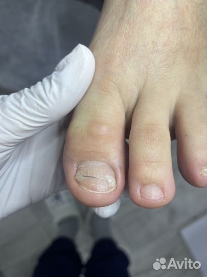 Аппаратный маникюр