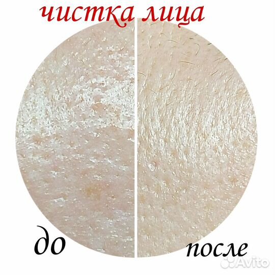 Косметология, коррекция фигуры