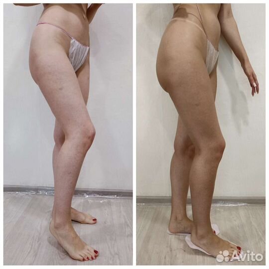 Моментальный загар