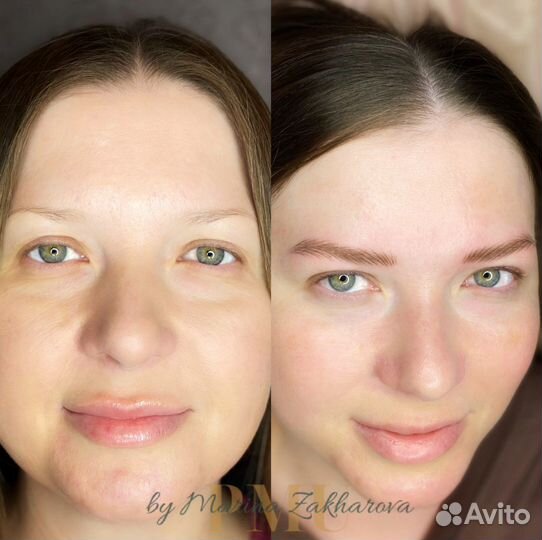 Волосковая техника, удаление пм,татуаж,перекрытие