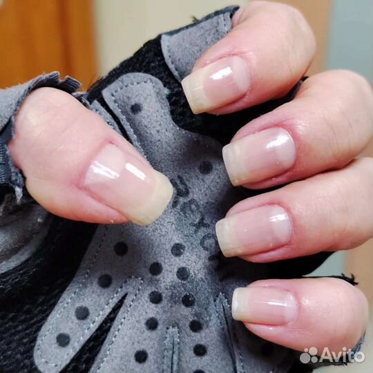 Реальное лечение грибка и вросших ногтей