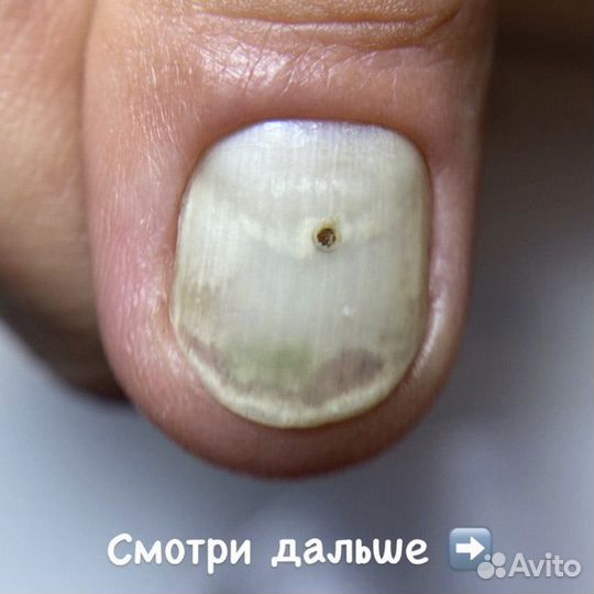 Медецинский педикюр.подолог.для мужчин И женщин