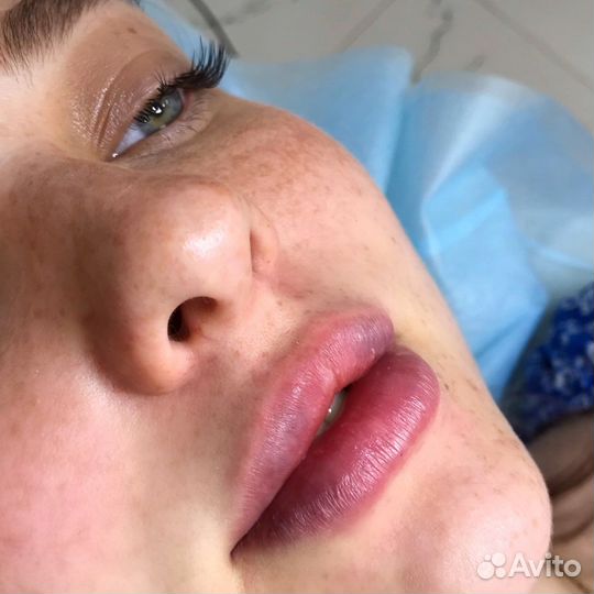 Ищу модель для увеличения губ