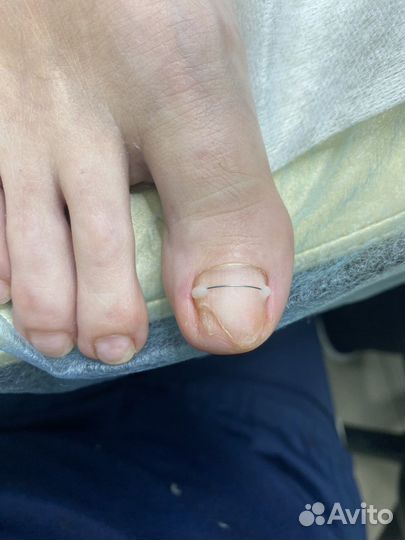 Услуги подолога