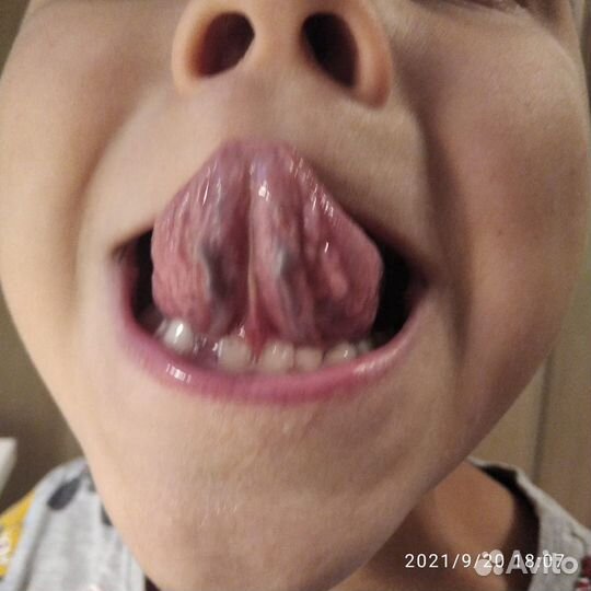 Логопед, нейро-дефектолог для детей и взрослых