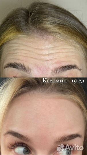 Услуги косметолога