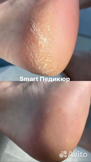 Апаратный маникюр 799