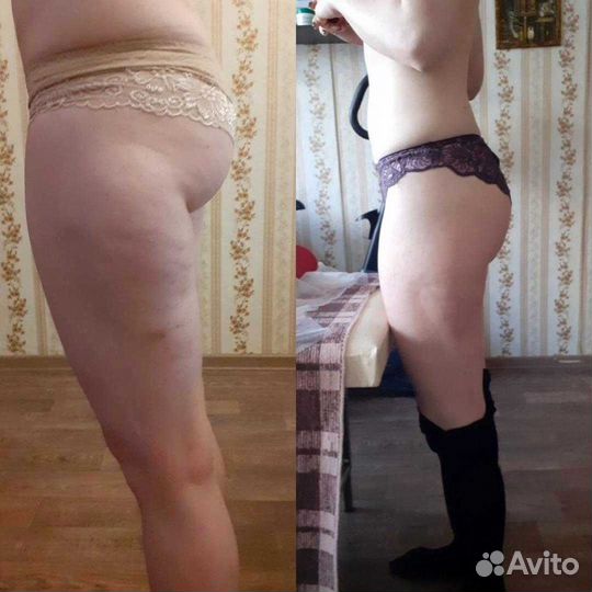 Антицеллюлитный массаж, классический, массаж лица