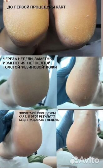 Маникюр, педикюр