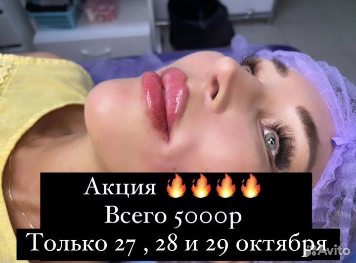 Увеличение губ