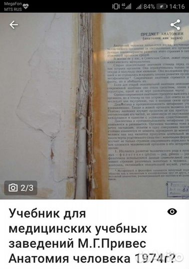 М.Г.Привес Анатомия человека 1974г.Антикварное изд