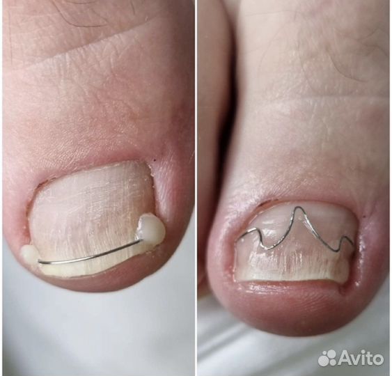 Подолог с медицинским образованием