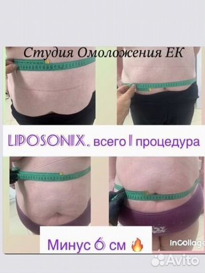 Liposonix Живот+ Бока