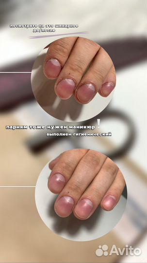 Маникюр с покрытием гель-лаком
