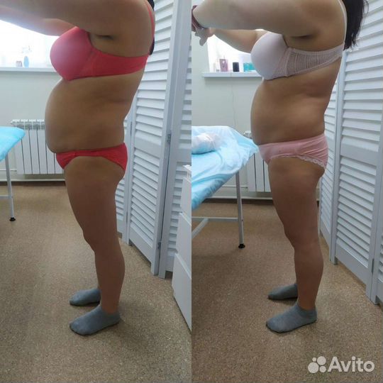 LPG, массаж тела и лица, коррекция фигуры