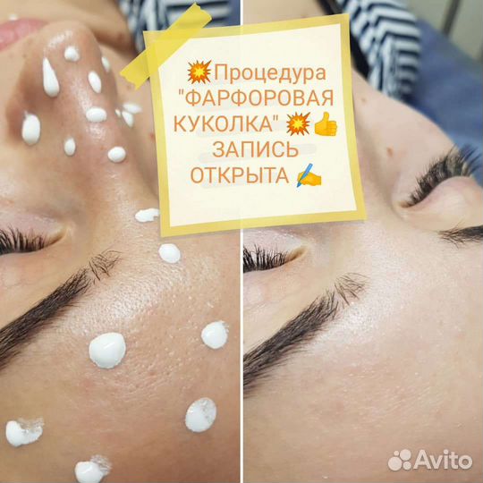 Услуги косметолога