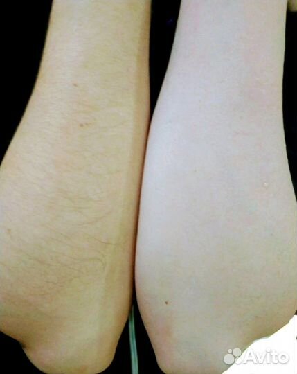 Депиляция, шугаринг