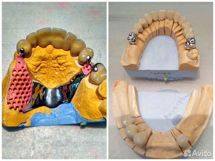 Зуботехнические работы