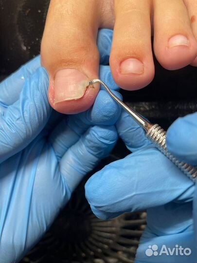 Педикюр/ Работа со сложной стопой