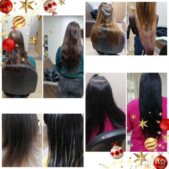 Загущение височной, затылочной области