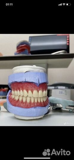 Обучение протезирование зубов для всех с наля