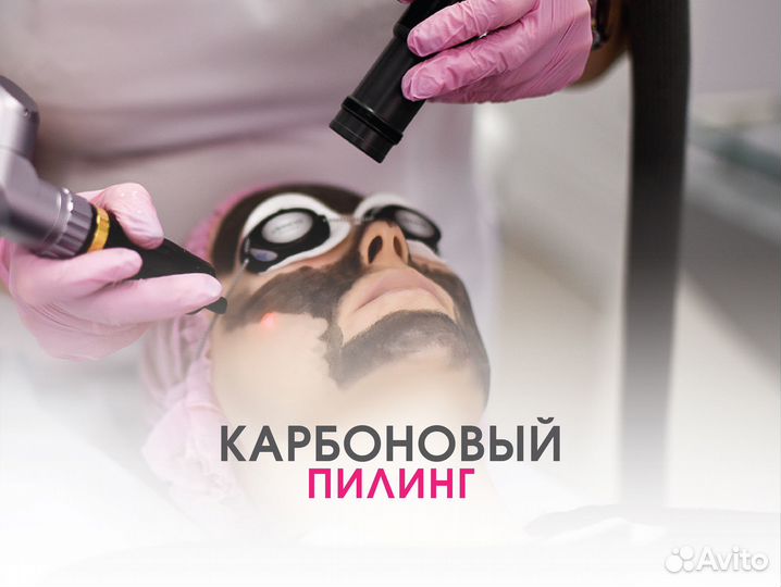 Карбоновый пилинг