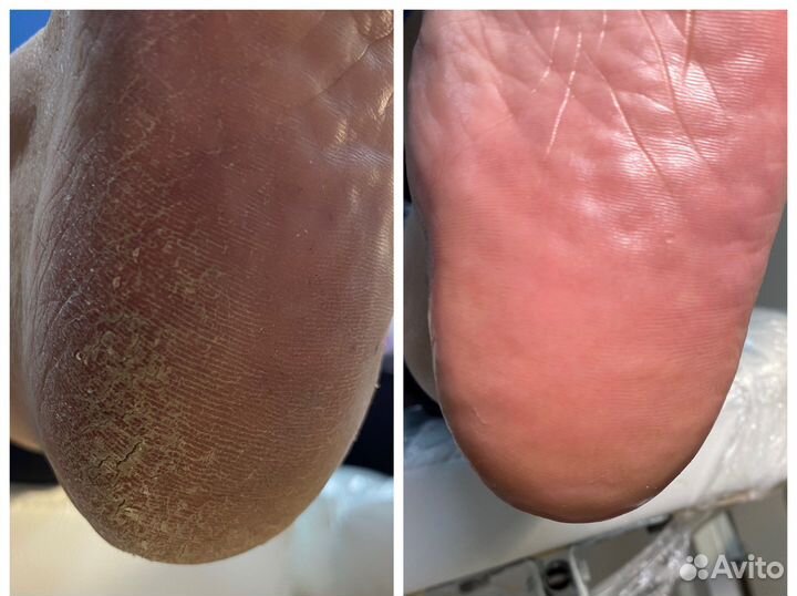 Маникюр педикюр наращивание