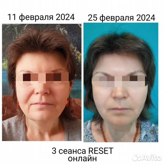 Reset (рисет); Массаж