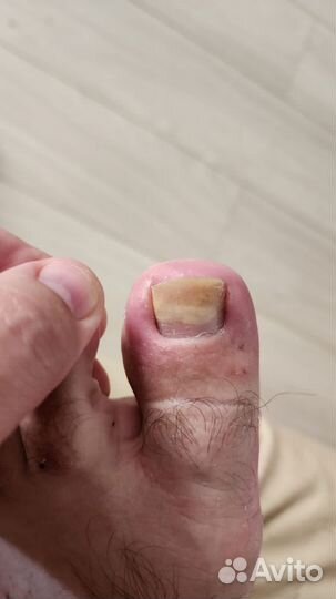 Желудочный сок Гюрзы 10%