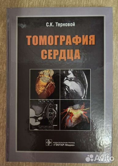 С. К. Терновой Томография сердца