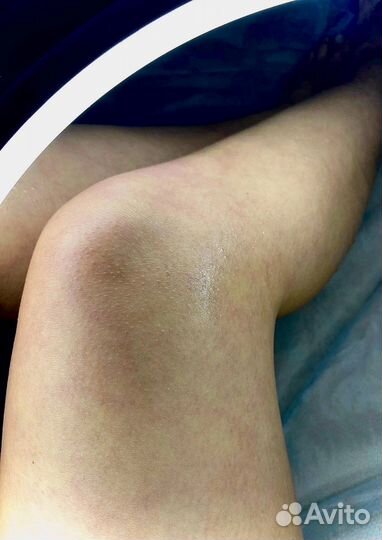 Шугаринг: бёдра