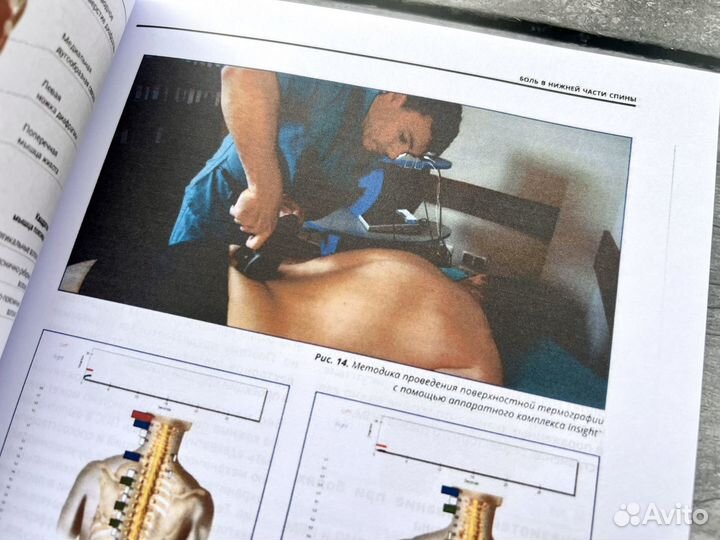 Мануальное мышечное тестирование