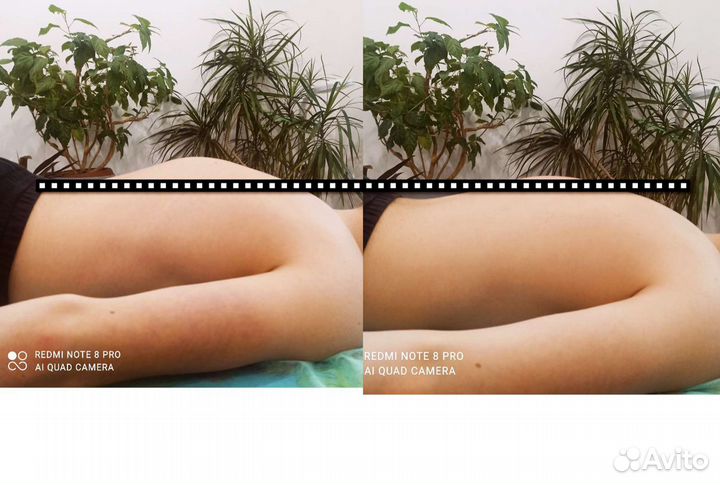 Массаж Челябинск (реабилитолог)