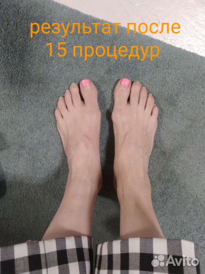 Массаж оздоровительный, миопрессура