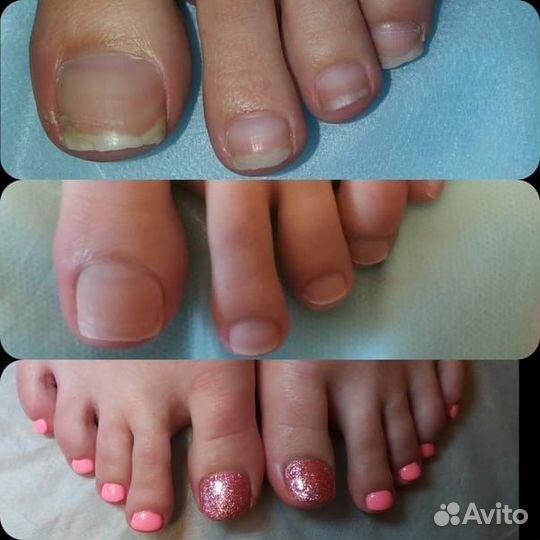 Смарт педикюр