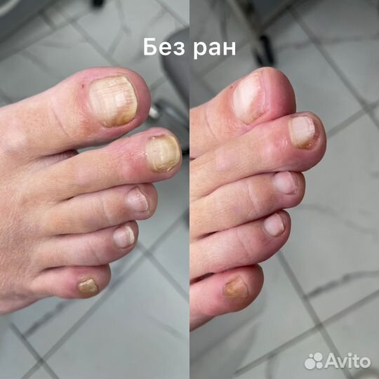 Подолог Педикюр