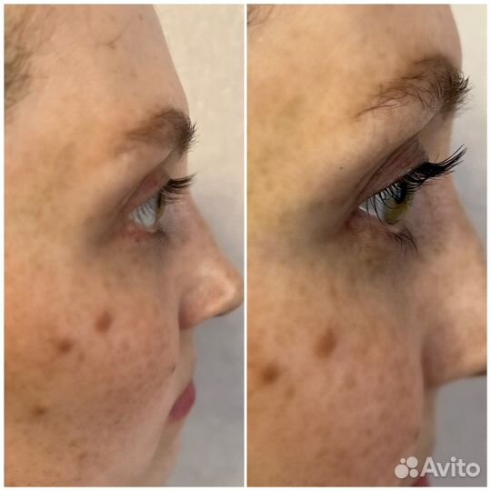 Ламинирование и ботокс ресниц