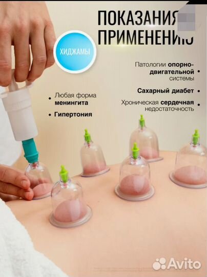 Вакуумные банки для массажа