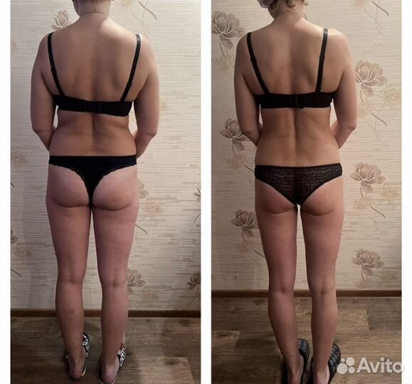 Массаж. LPG массаж.Выезд на дом