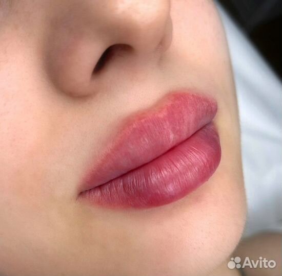 Увеличение губ