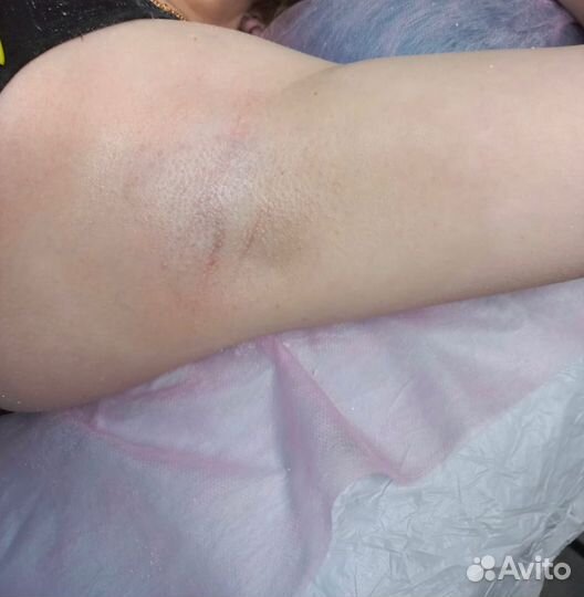 Мастер восковой депиляции