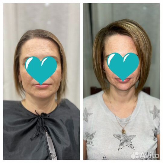 Прикорневой объем 