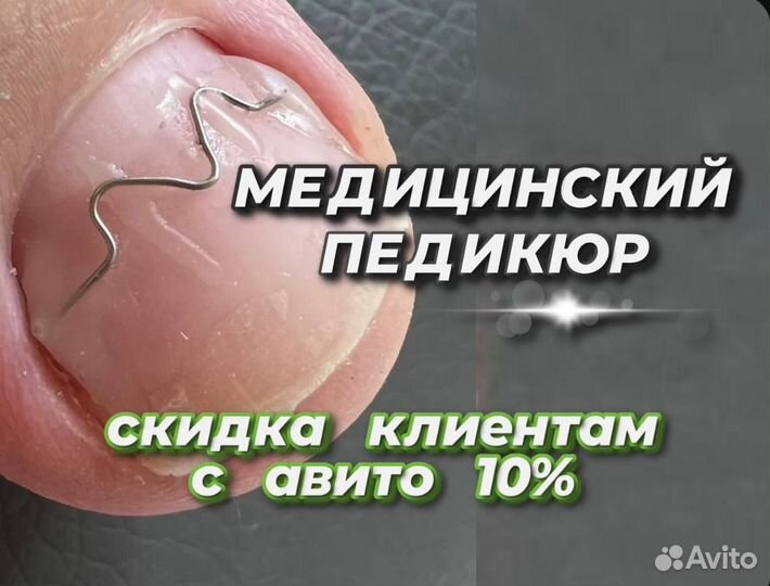 Подолог / Лечебный педикюр