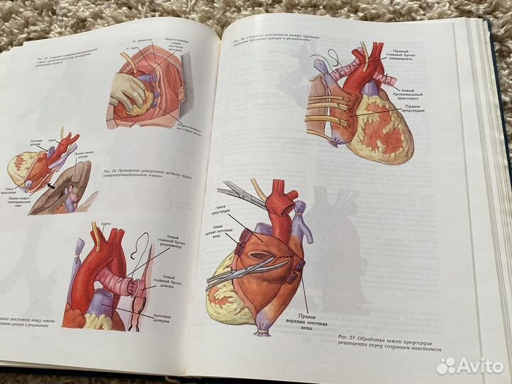 Транспоатология. Руководство (В. И. Шумаков)