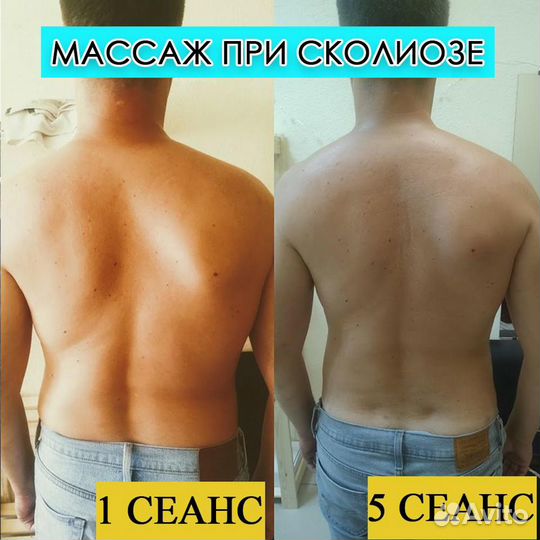 Массаж и Аппаратные процедуры по телу в Муроме