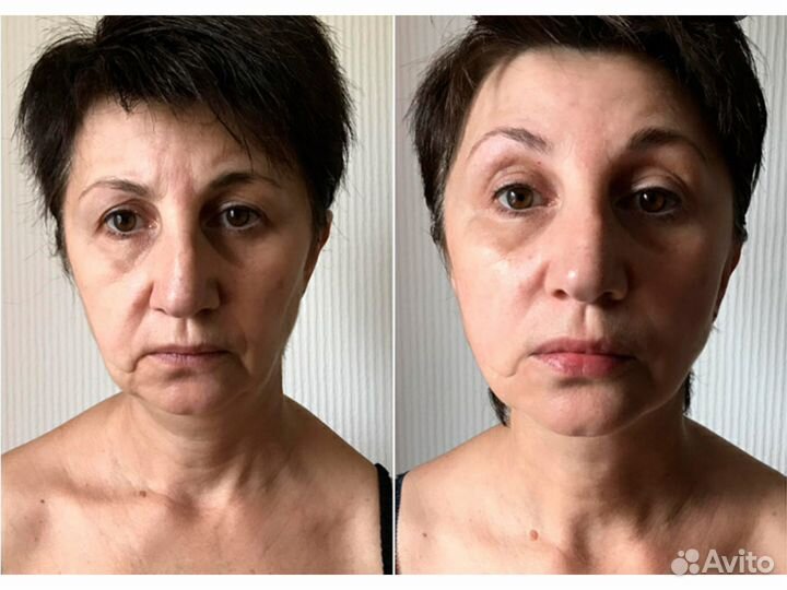 Коррекция фигуры и лица