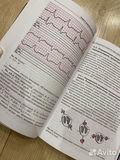 Эхокардиография