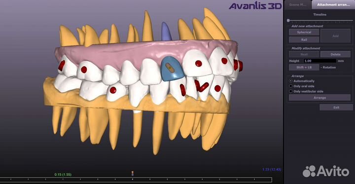 Программа для стоматологов Avantis 3D