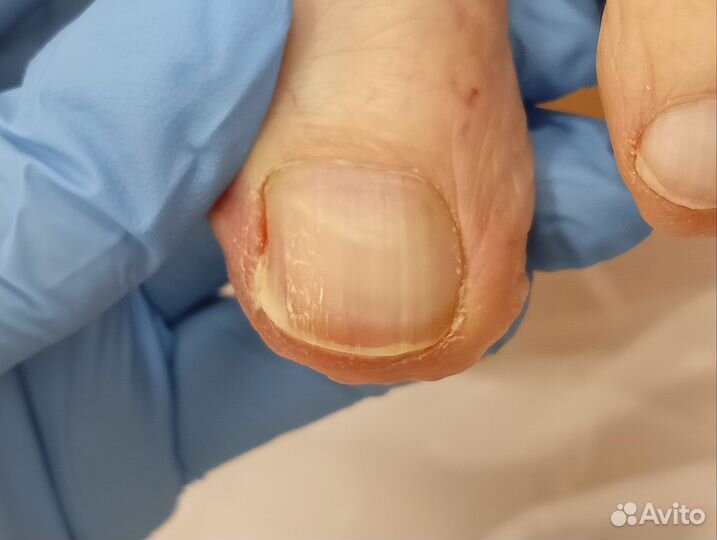 Услуги подолога